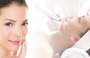 Microagulhamento_facial
