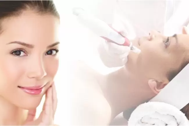 Microagulhamento_facial