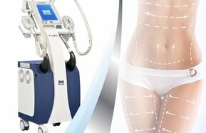 Criolip%c3%b3lise_de_suc%c3%a7%c3%a3o_banner_procedimento_v1