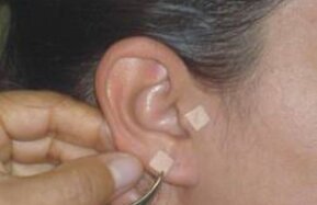 Auriculo